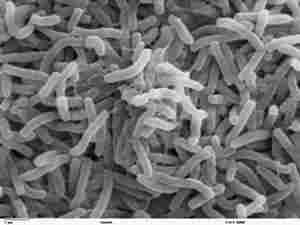 Vibrio cholerae al microscopio elettronico