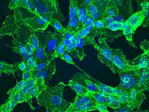 Cellule di fibrosarcoma in cui sono evidenti le proteine filamentose delle membrane cellulari (verdi) e i nuclei (blu) 