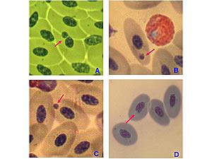 Fotografie al microscopio ottico di anomalie del nucleo e di micronuclei