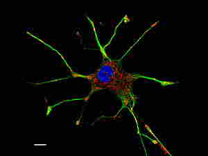 Cellula PC-12 al microscopio confocale. In blu il nucleo, in rosso i mitocondri e in verde i microtubuli