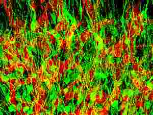 Cellule progenitrici di neuroni nel bulbo olfattivo di topo, colorate in verde