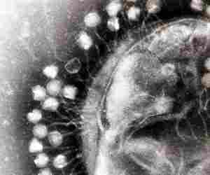 Superficie di cellula batterica attaccata da fagi. Immagine al microscopio elettronico. 