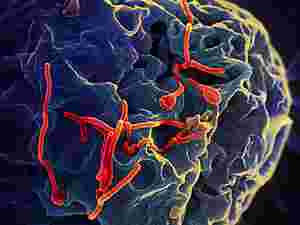 Sulla superficie di una cellula VERO stanno gemmando particelle virali di virus Ebola